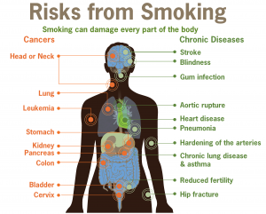 "Smoking can damage every part of the body" 